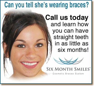 Blue Back Ortho - Can you tell she is wearing braces?